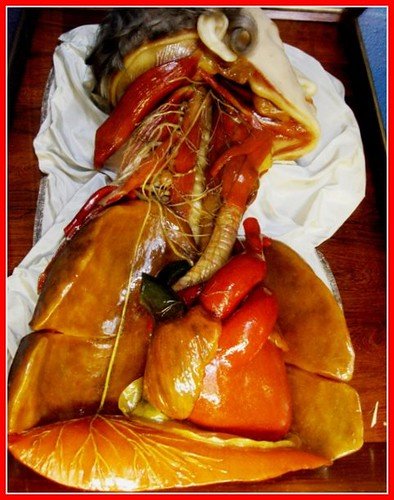Anatomical model of the human body