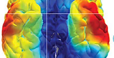 Scientific illustration of the human brain and its neural connections